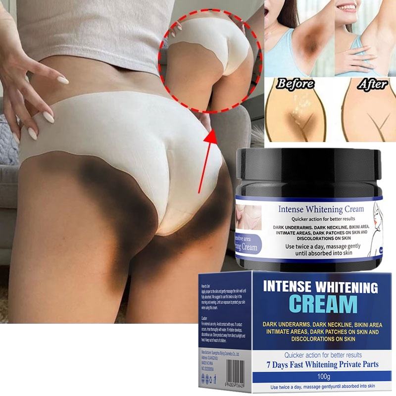 Intense Whitening Cream — Zones Intimes & Aisselles