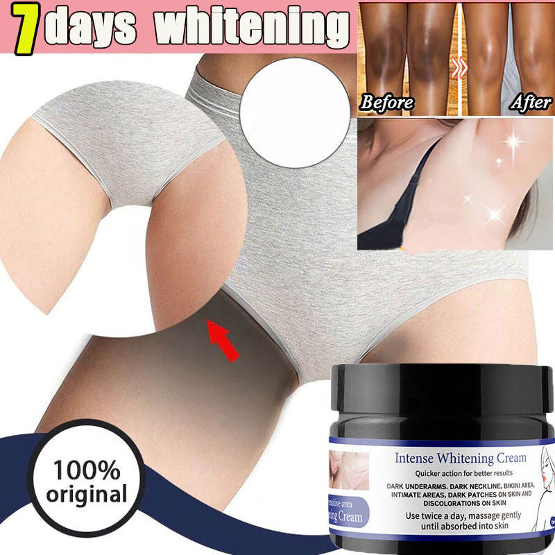 Intense Whitening Cream — Zones Intimes & Aisselles